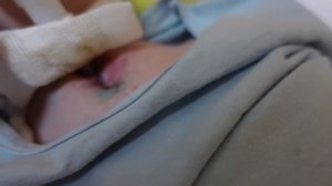 VLOG: операция и три недели в больнице