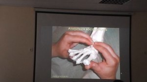 Атипичная косолапость. Громов Илья Валерьевич.