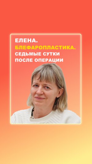 Елена. Блефаропластика. 7 сутки после операции