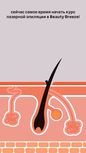 Сейчас самое время начать курс лазерной эпиляции!? смотреть онлайн