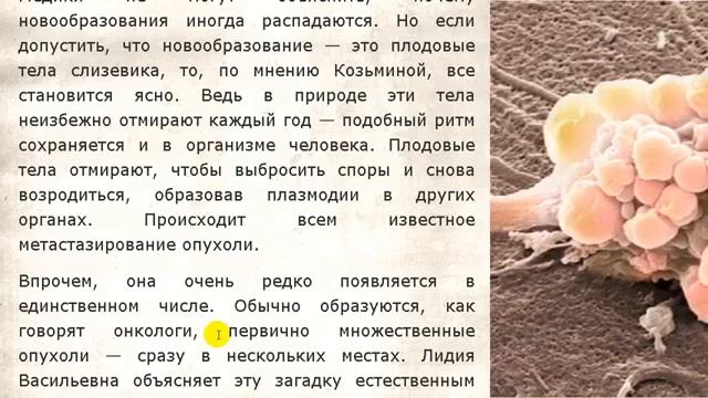 Лидия Козьмина - Увы, такова горькая правда  нас едят г?