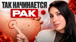 Как не пропустить рак на ранней стадии