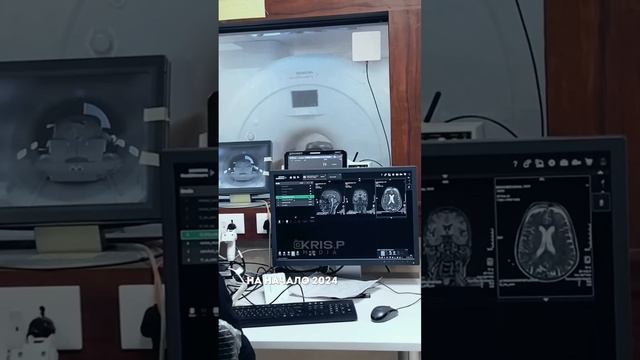 ОСМС (Обязательное социальное медицинское страховани