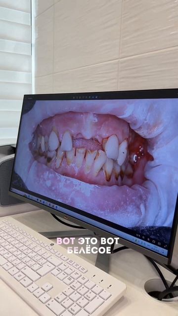 ПРОВЕРЬ, ЕСТЬ ЛИ У ТЕБЯ ЭТО ЗАБОЛЕВАНИЕ? ПАРОДОНТИТ смотреть онлайн