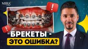 ВСЯ ПРАВДА О БРЕКЕТАХ: больно, дорого и не факт, что поможет?