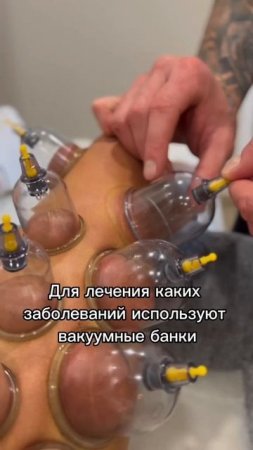 Методы вакуумного массажа