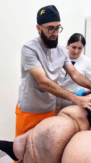 Осложнения лимфостаза. Слоновость смотреть онлайн