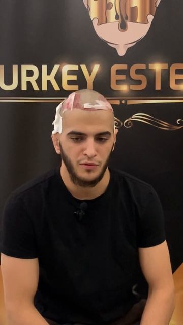 Как себя чувствует пациент после пересадки волос. shorts