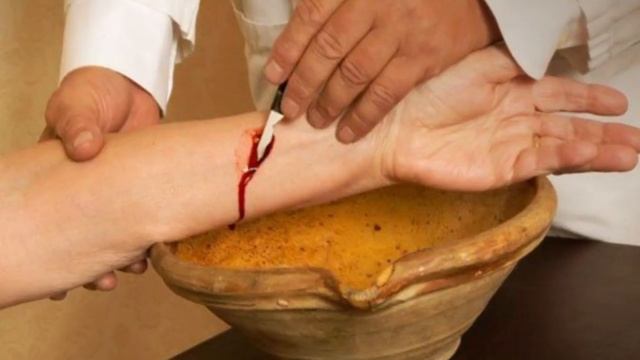 УЖАСЫ МЕДИЦИНЫ  СТРАШНЫЕ СПОСОБЫ ЛЕЧЕНИЯ о которых лучше забыть навсегда   Интересные факты