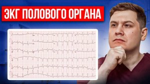 ЭКГ полового органа это реально? Личный опыт пациента и мнение уролога!