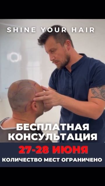 #пересадкаволос #пересадкабороды #втопе #санктпетербу