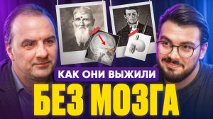 Истории людей, выживших после чудовищных травм мозга. Загадки нейронауки