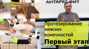 Протезирование нижних конечностей: Первый этап.