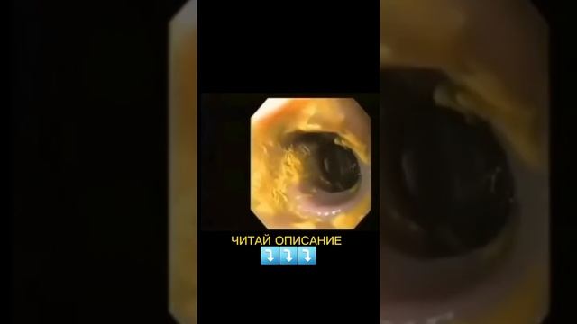 Есть ли у вас паразиты? смотреть онлайн