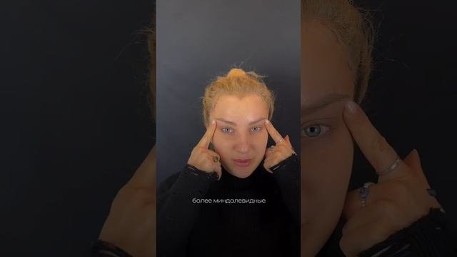 Височная подтяжка, удаление комков Биша #подтяжкалица