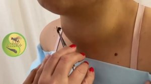 Апитерапия при щитовидной железе