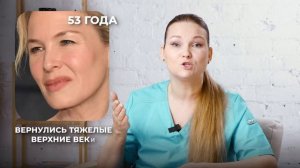 РЕНЕ ЗЕЛЬВЕГЕР - НЕОБРАТИМЫЕ ПОСЛЕДСТВИЯ ПЛАСТИКИ?!