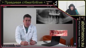 Правдивая стоматология проф Аболмасов Н.Н. - Часть 89 "Имплантация при полной потере зубов. Методы!"