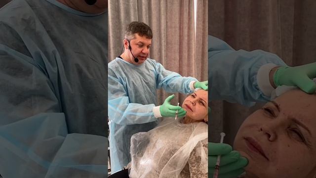 Коррекция ботоксом межбровья, мимических морщин лба и