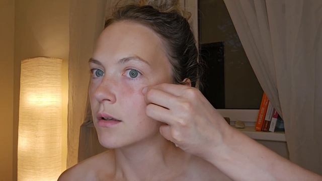 ♡ КОРРЕКЦИЯ НОСОСЛЁЗНОЙ БОРОЗДЫ И ПРОВАЛОВ ПОД ГЛАЗА?