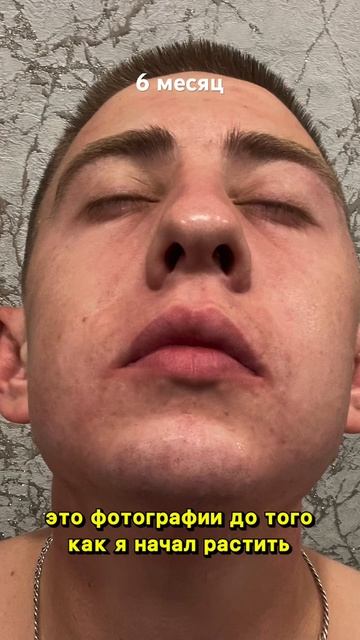 6 МЕСЯЦЕВ КАК Я ИСПОЛЬЗУЮ КСИНОКСИН// МИНОКСИДИЛ смотреть онлайн