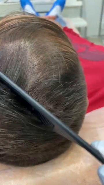 Трихопигментация головы shorts трихопигментация косметолог