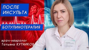Как вернуть подвижность руке и ноге после инсульта