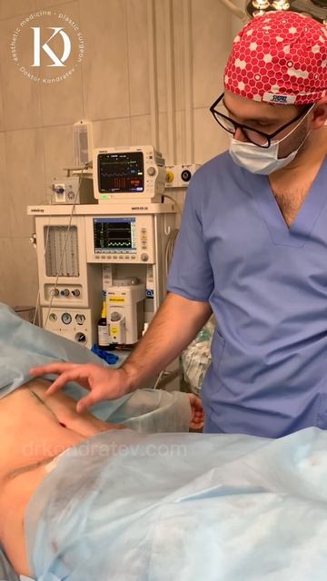 Абдоминопластика от DK #пластическаяхирургиямосква #абдоминопластика