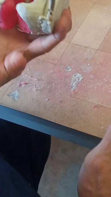 постановка зубов#сьемный протез смотреть онлайн