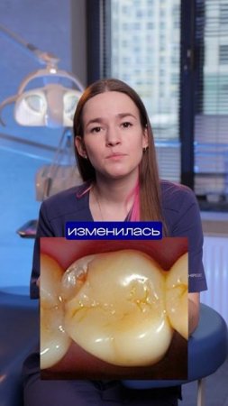 4 признака, что твоя пломба уже вредит — а ты даже не догадываешься😱 #пломба #кариес #заменапломбы