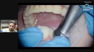 Дмитрий Колесников - Препарирование зубов под коронки, виниры, накладки