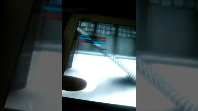 Обзор узи смотреть онлайн