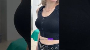 Подтяжка груди без имплантов! Послеродовые изменения.