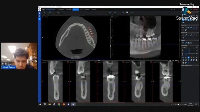 Romexis Viewer (Planmeca) - Юрий Седов смотреть онлайн