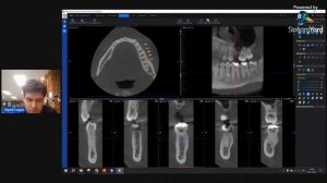 Romexis Viewer (Planmeca) - Юрий Седов