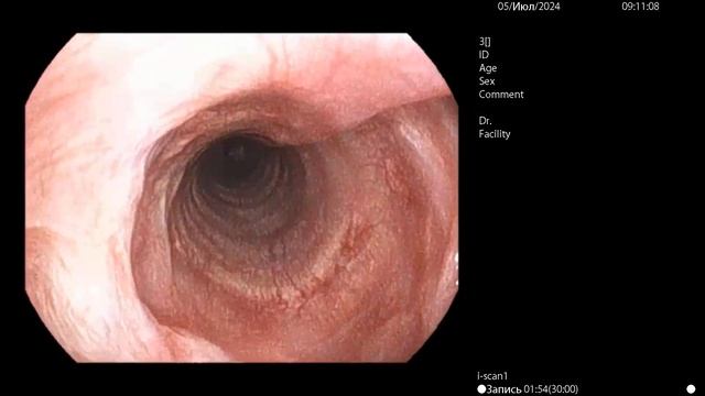 Рубцовый стеноз трахеи у собаки