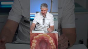 Сложные случаи лечения прикуса. Дудкин А.О.