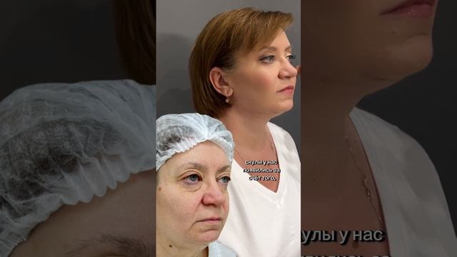 Фейслифтинг, круговая пластика век,платизмопластика,?