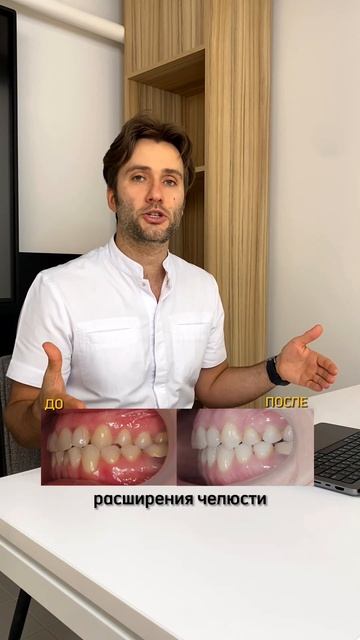 Что такое перекрестный прикус❓ смотреть онлайн