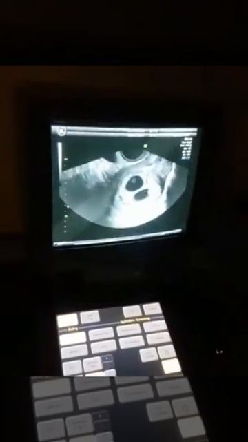 ТРОЙНЯААА!В ЕСТЕСТВЕННОМ цикле!