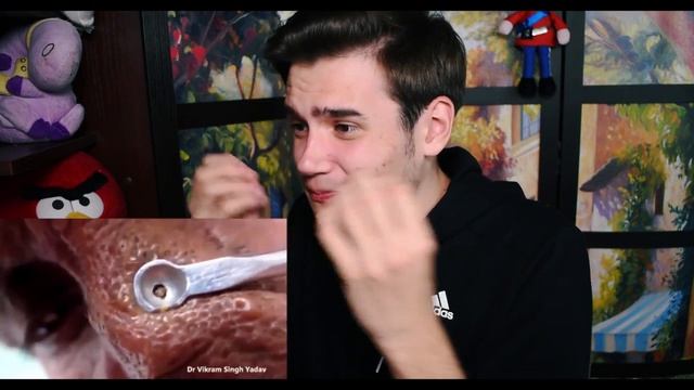 Удаление чёрных точек на лице |МЕРЗОСТЬ| смотреть онлайн