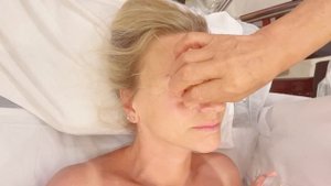 Косметическая акупунктура лица. Акупунктурный лифтин