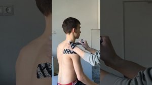 Вариант тейпирования плечевого сустава