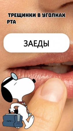📛 ЗАЕДЫ