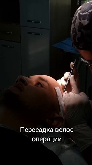 Пересадка волос в Турции #пересадкаволос #пересадкаво смотреть онлайн