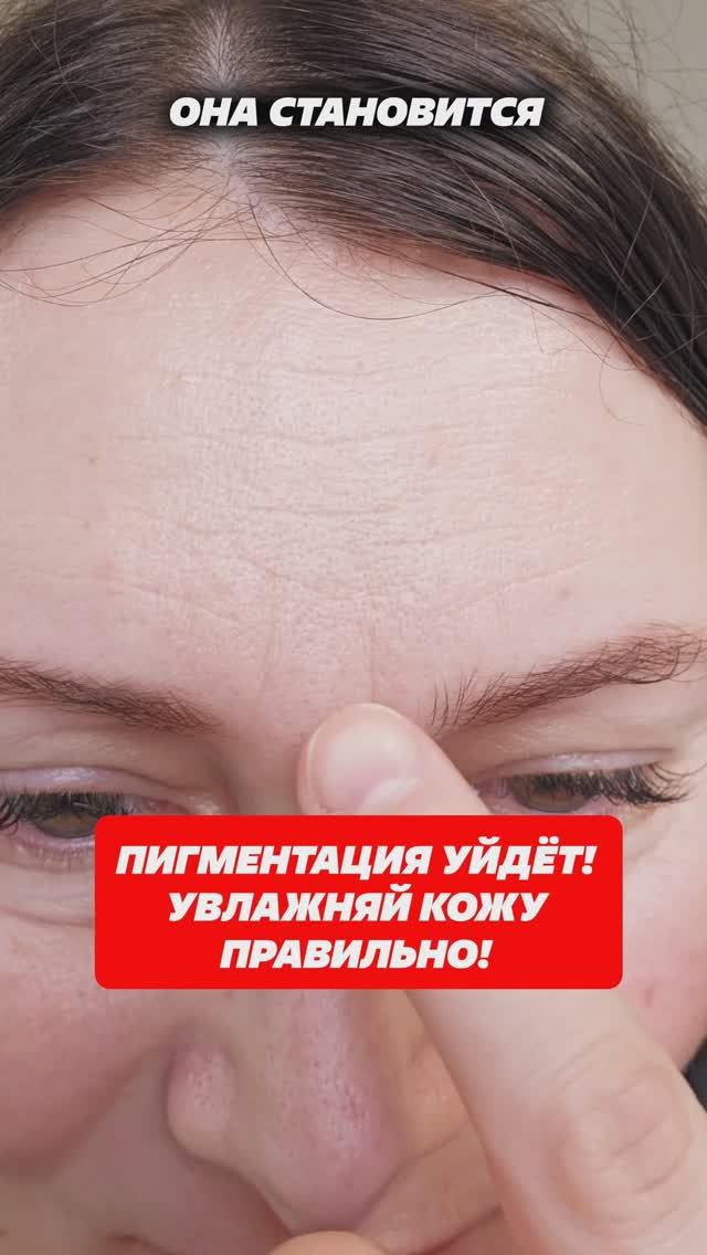 Пигментация уйдет! Увлажняйте кожу правильно! Артикул 332672322 #кожа #пигментация #пигмент #крем