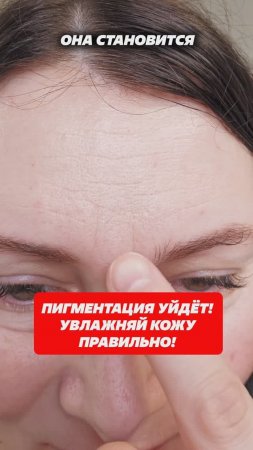 Пигментация уйдет! Увлажняйте кожу правильно! Артикул 332672322 #кожа #пигментация #пигмент #крем