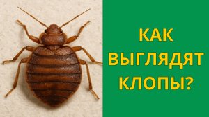 Как выглядят клопы постельные и укусы на теле человека?