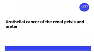 Urothelial cancer of the renal pelvis and ureter