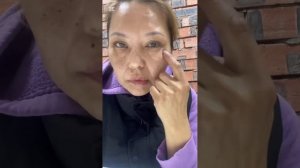 ПАРЕЗ ЛИЦЕВОГО НЕРВА. Делюсь результатами нейропласт?